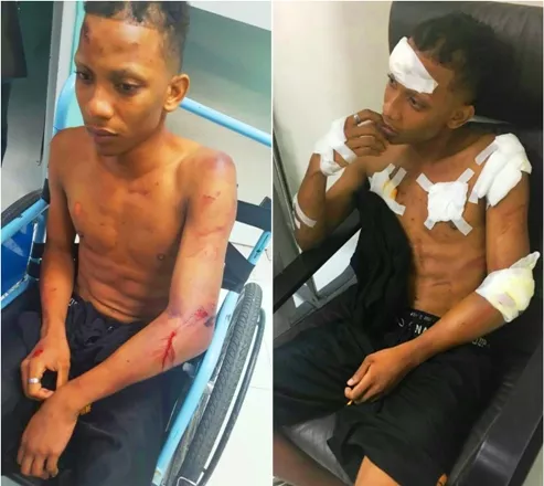 Exigen investigación sobre golpiza y violación a joven en Puerto Plata